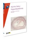 Obrázok - Rýchle fakty: Hyperlipidémia