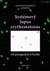Obrázok - Systémový lupus erythematosus /od patogenézy k liečbe