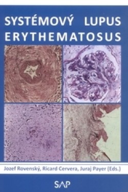 Obrázok - Systémový lupus erythematosus