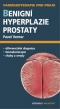 Kniha - Benigní hyperplazie prostaty